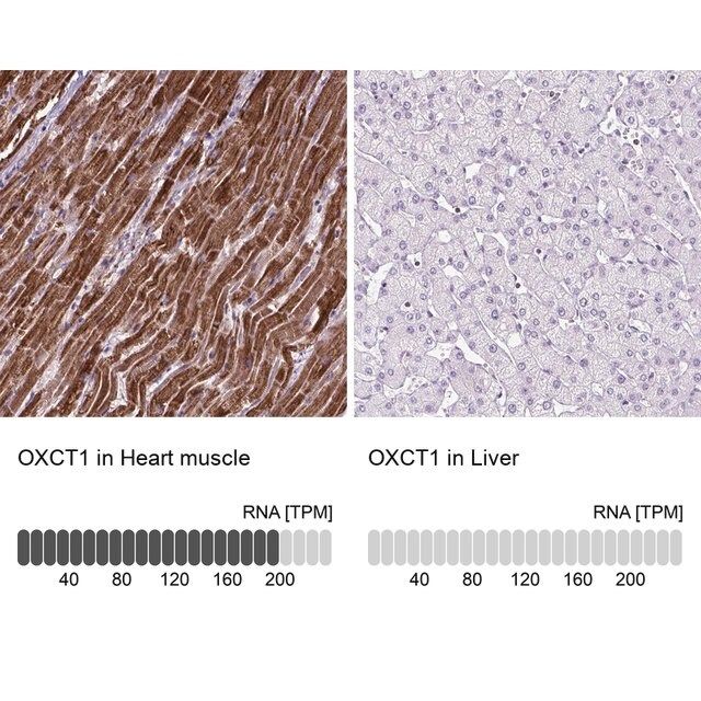 Anti-OXCT1 antibody produced in rabbit