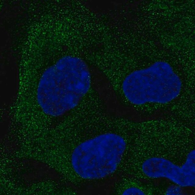 Anti-PAIP2B antibody produced in rabbit