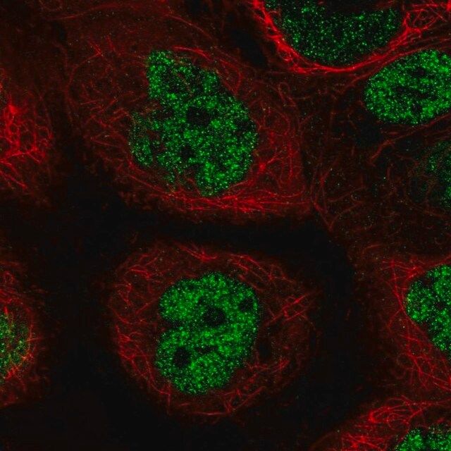 Anti-PALB2 antibody produced in rabbit