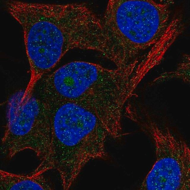 Anti-PAK1IP1 antibody produced in rabbit