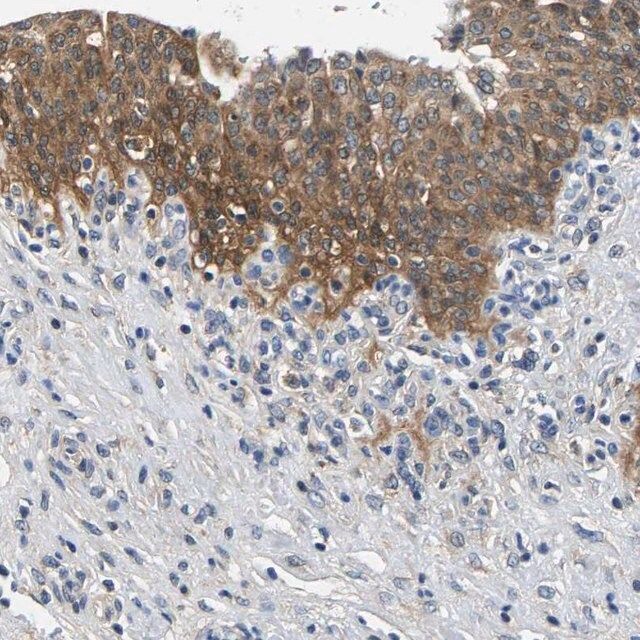 Anti-NT5C antibody produced in rabbit