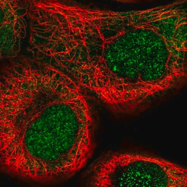 Anti-NSUN5 antibody produced in rabbit