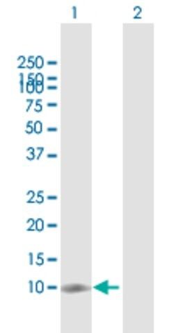 Anti-NT5C antibody produced in rabbit