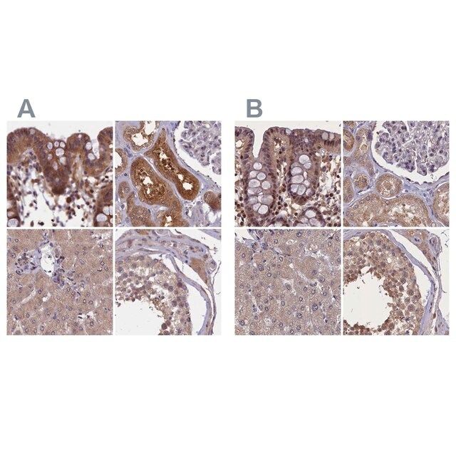 Anti-NUBP1 antibody produced in rabbit