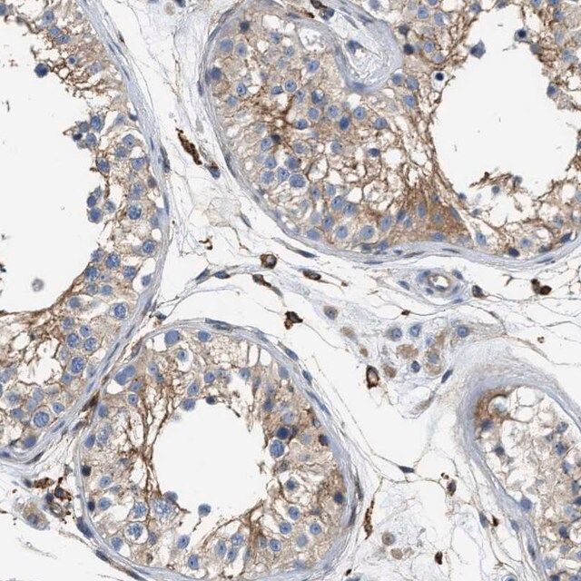 Anti-NSUN7 antibody produced in rabbit