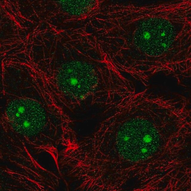 Anti-NSUN5 antibody produced in rabbit