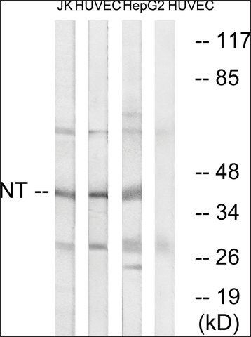 Anti-NT antibody produced in rabbit