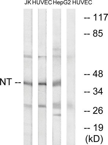 Anti-NT antibody produced in rabbit