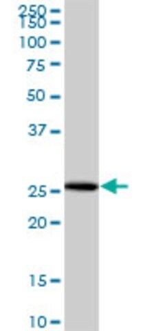 Anti-NUBP2 antibody produced in mouse