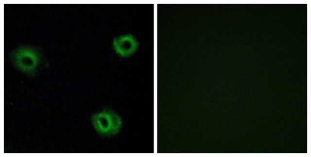 Anti-NTR2 antibody produced in rabbit