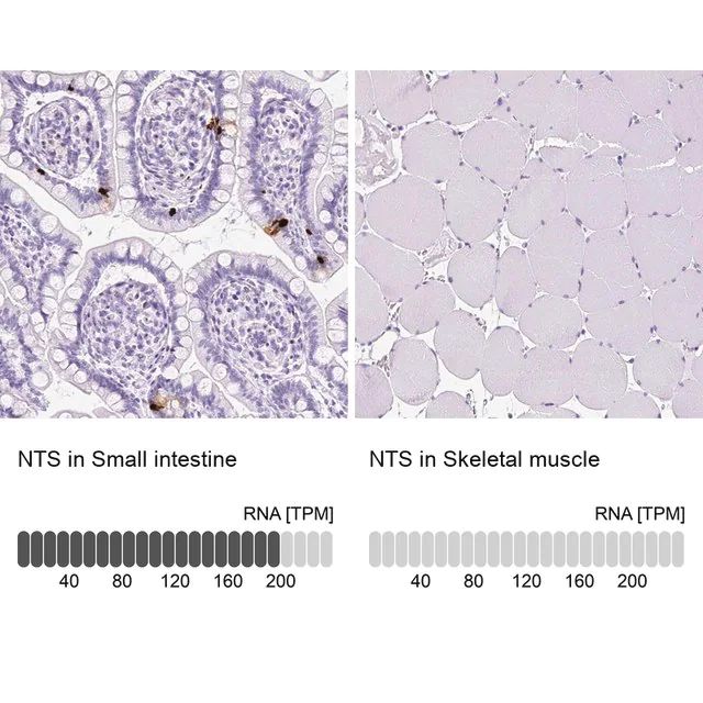 Anti-NTS antibody produced in rabbit