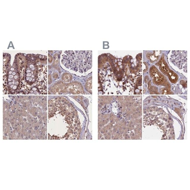 Anti-NUBP1 antibody produced in rabbit