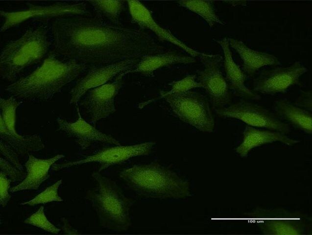 Anti-NUDT5 antibody produced in rabbit