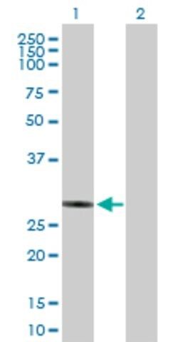 Anti-NUBPL antibody produced in mouse