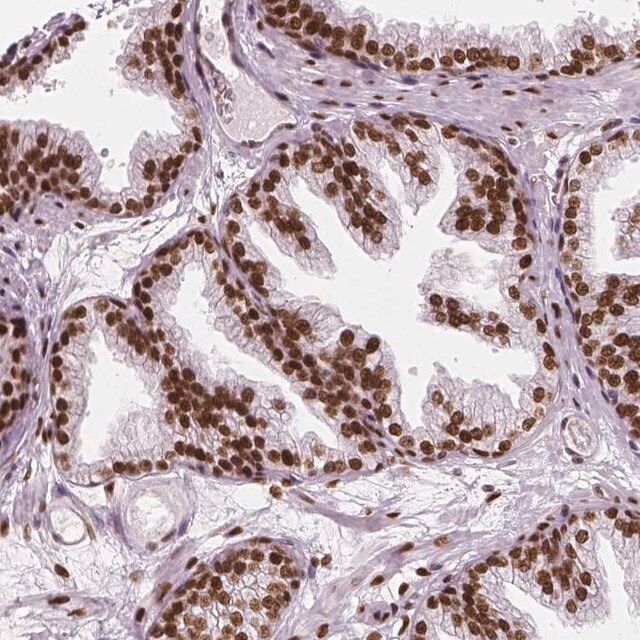 Anti-NUCKS1 antibody produced in rabbit