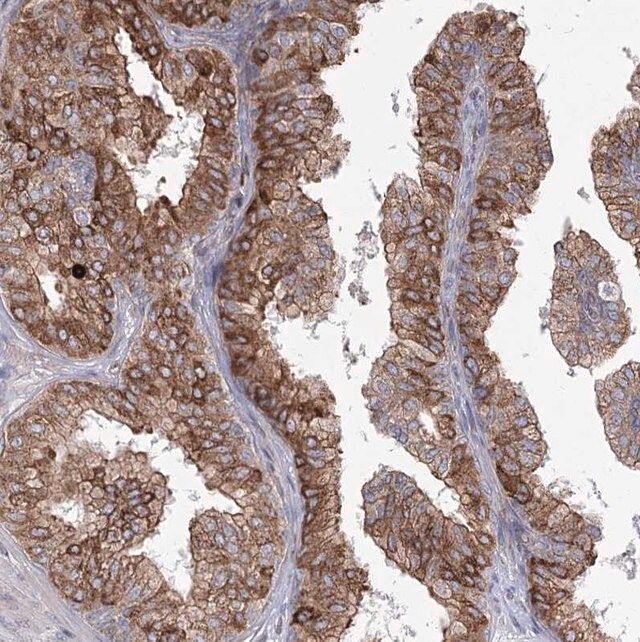 Anti-NHLRC2 antibody produced in rabbit