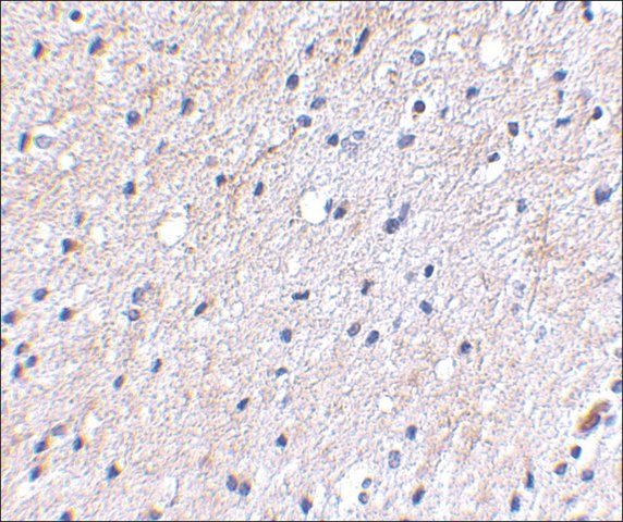 Anti-NIPSNAP (ab1) antibody produced in rabbit