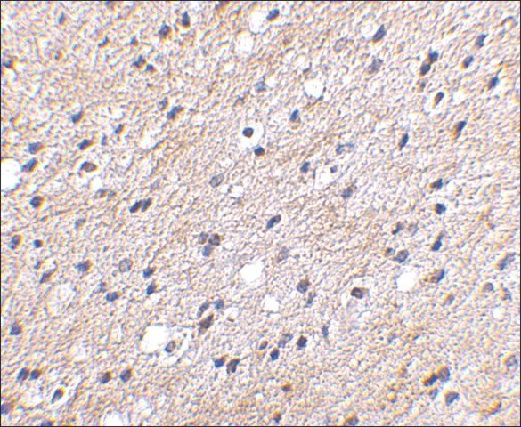 Anti-NIPSNAP (ab2) antibody produced in rabbit