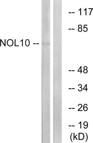 Anti-NOL10, C-Terminal antibody produced in rabbit