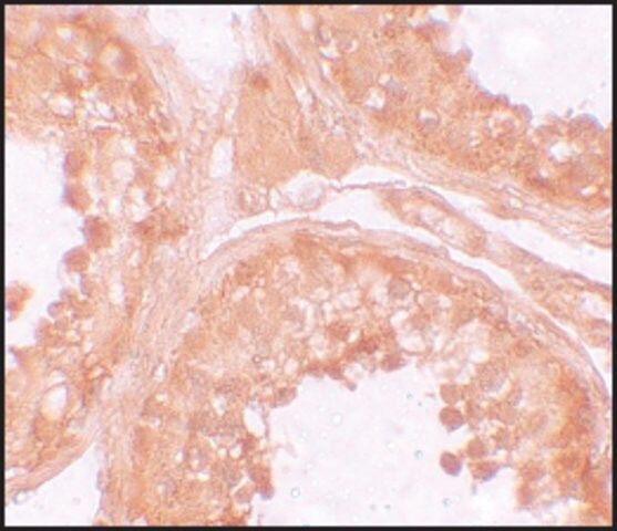 Anti-NOD6 antibody produced in rabbit