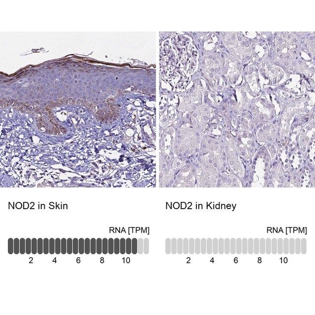 Anti-NOD2 antibody produced in rabbit