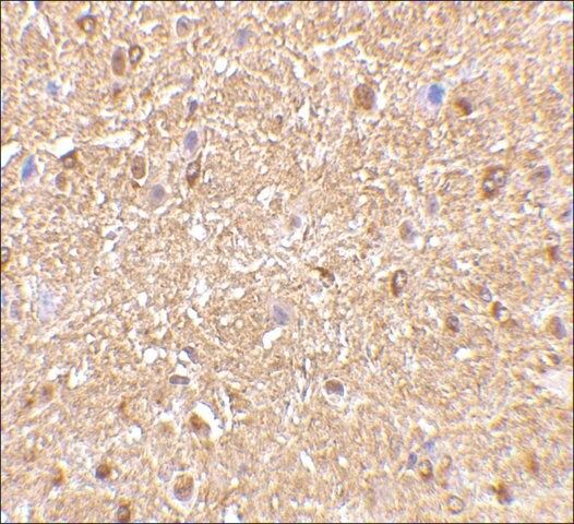 Anti-NOGOA (ab1) antibody produced in rabbit