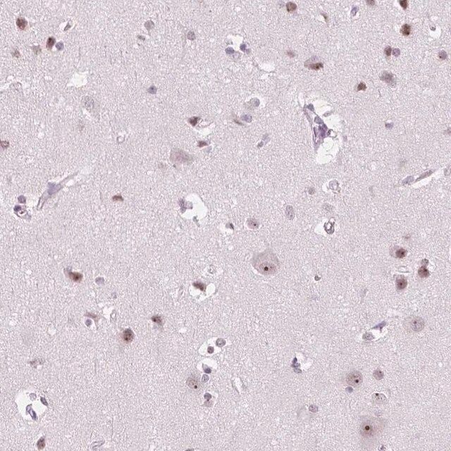 Anti-NOLC1 antibody produced in rabbit