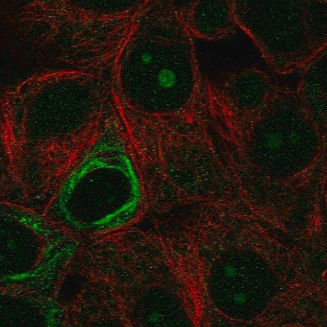 Anti-NOL9 antibody produced in rabbit