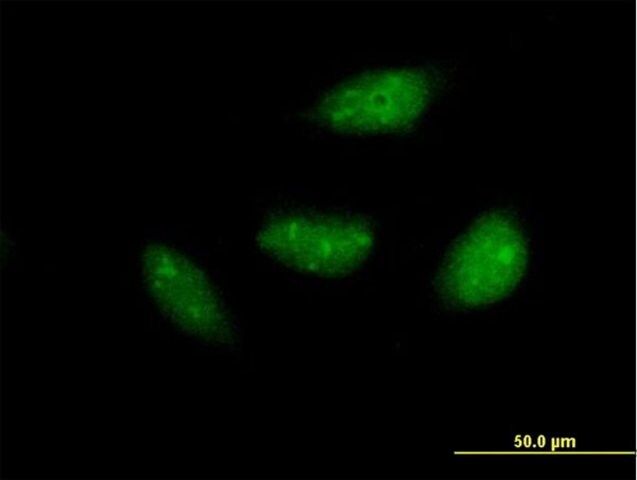 Anti-NOL6 antibody produced in mouse