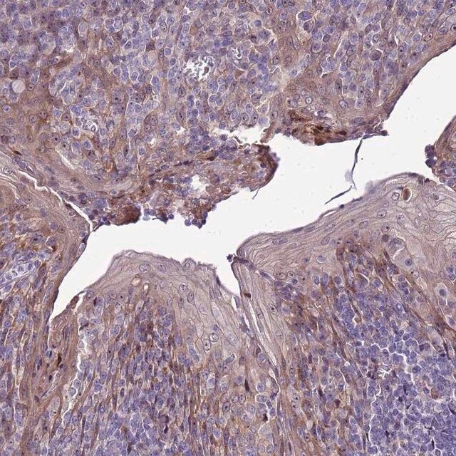 Anti-NOL8 antibody produced in rabbit