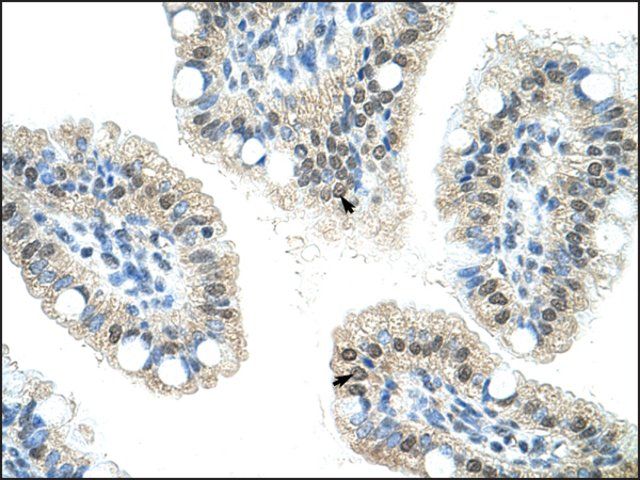 Anti-NOL6 antibody produced in rabbit