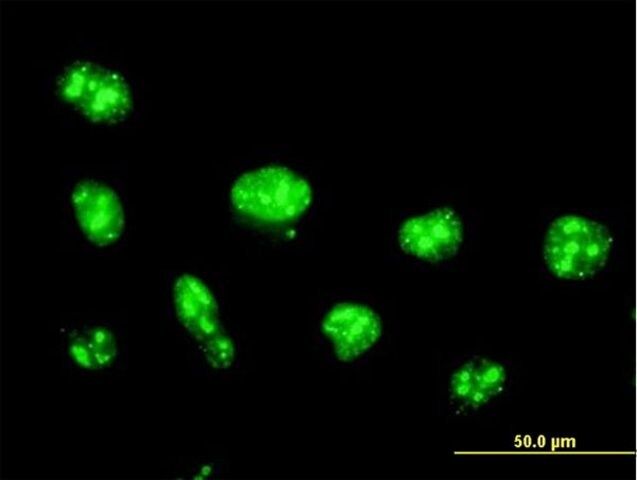 Anti-NOLC1 antibody produced in mouse