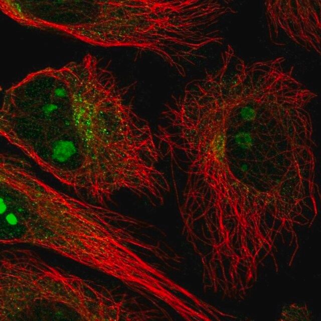 Anti-NCKAP5 antibody produced in rabbit