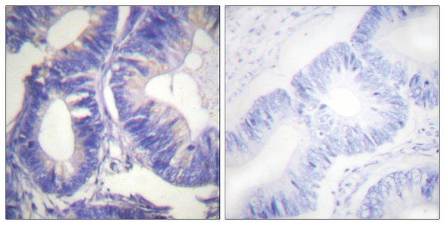 Anti-NCK2 antibody produced in rabbit