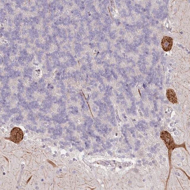 Anti-NCKAP5 antibody produced in rabbit