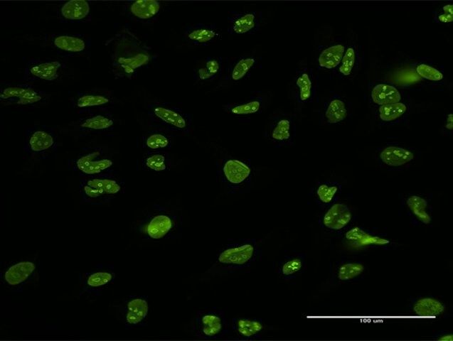 Anti-NCL antibody produced in mouse