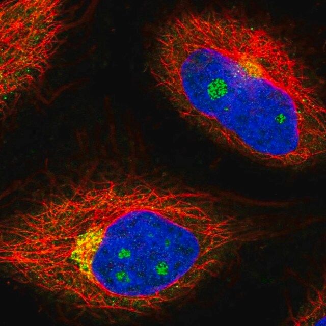 Anti-NCOA4 antibody produced in rabbit