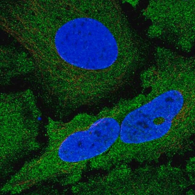 Anti-NCKIPSD antibody produced in rabbit