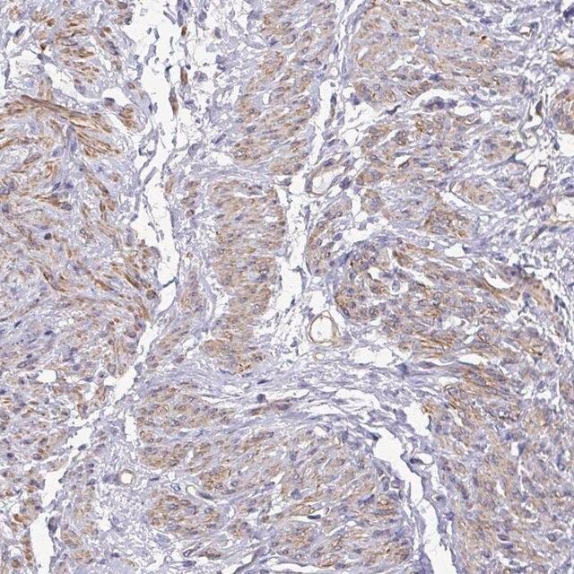 Anti-MYL6 antibody produced in rabbit