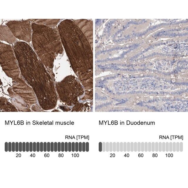 Anti-MYL6B antibody produced in rabbit