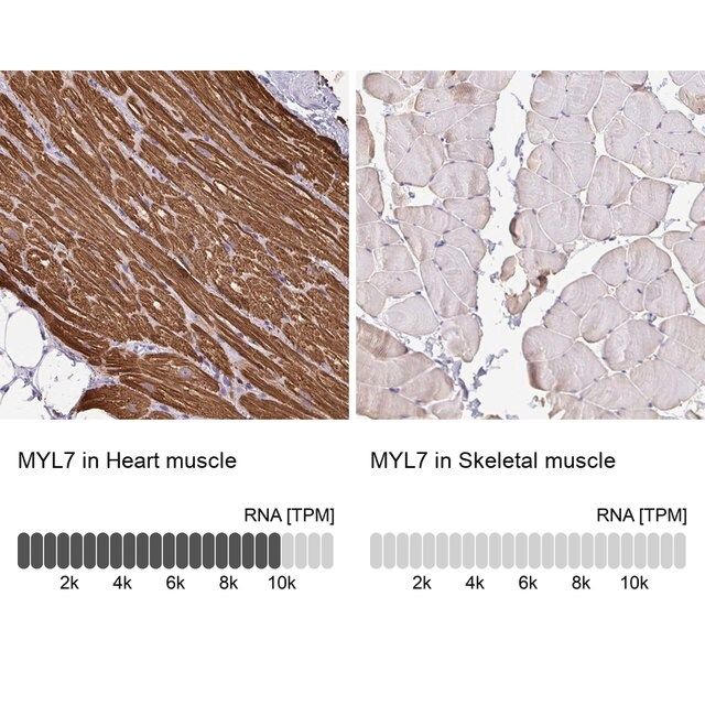 Anti-MYL7 antibody produced in rabbit