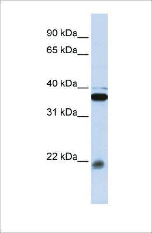 Anti-MYL9 antibody produced in rabbit