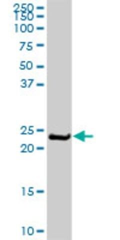 Anti-MYL6B antibody produced in rabbit