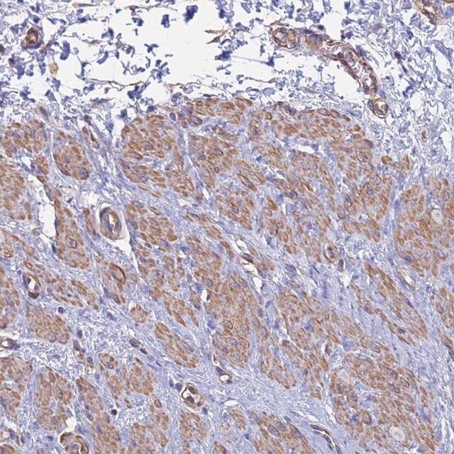 Anti-MYL12B antibody produced in rabbit