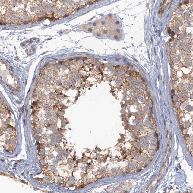 Anti-MYO16 antibody produced in rabbit