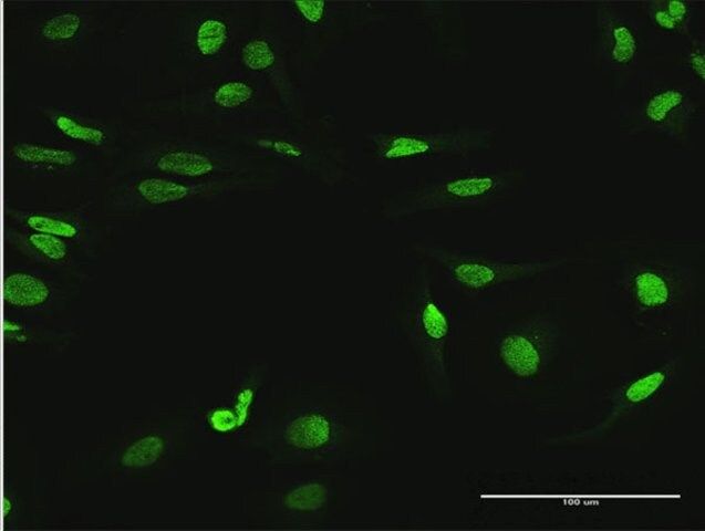 Anti-MYNN antibody produced in mouse