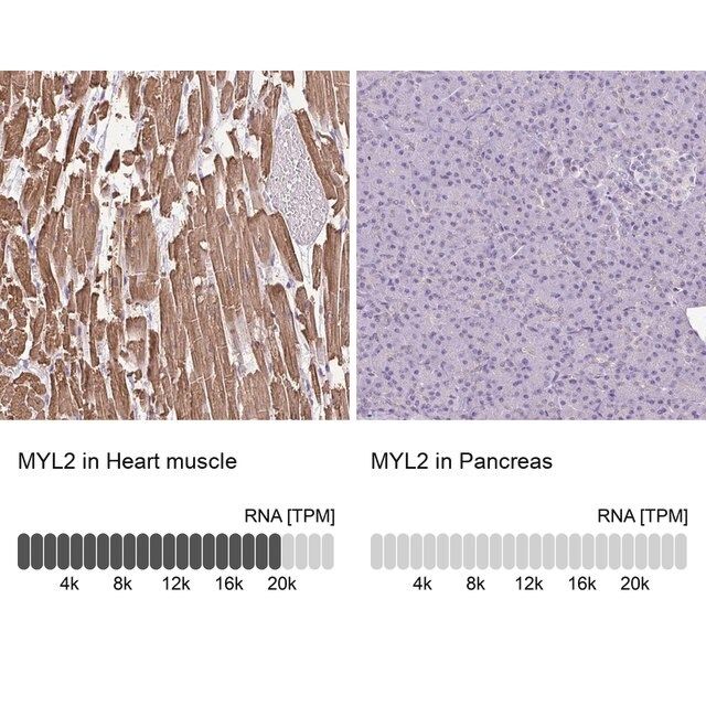 Anti-MYL2 antibody produced in rabbit