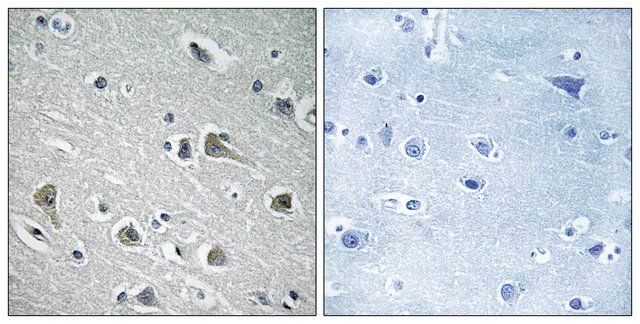 Anti-MYLIP antibody produced in rabbit