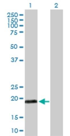 Anti-MYL5 antibody produced in rabbit