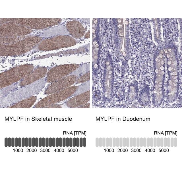 Anti-MYLPF